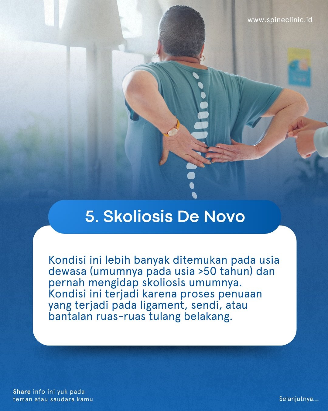skoliosis de novo