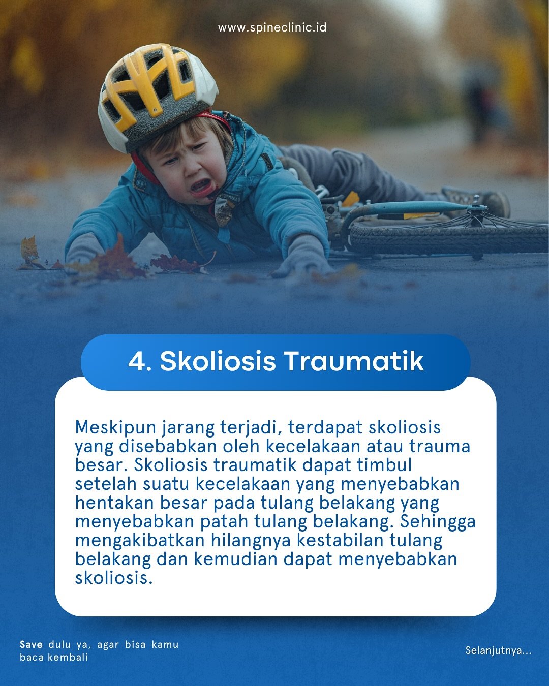 skoliosis traumatik
