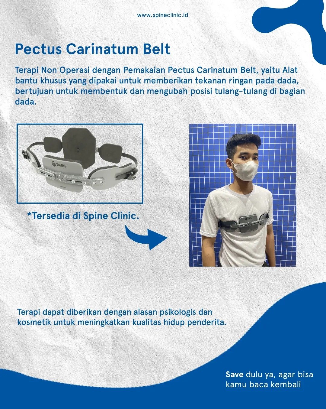 terapi non operasi pectus carinatum