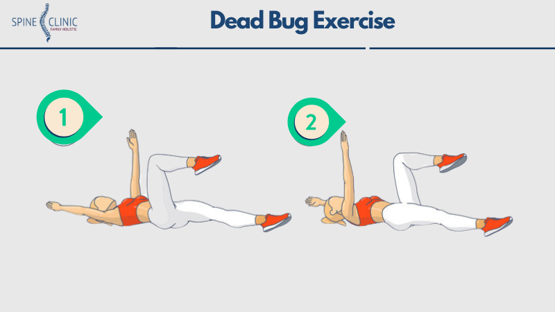 apa itu dead bug exercise