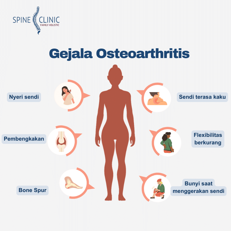Gejala Osteoarthritis