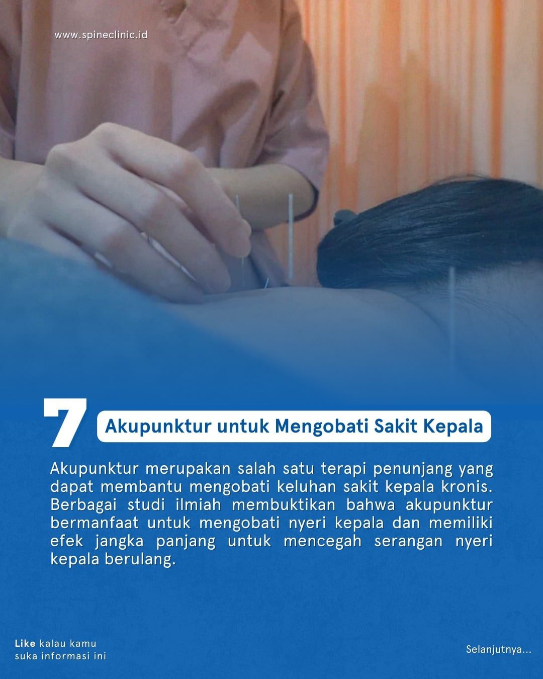 sakit kepala dengan akunpunktur