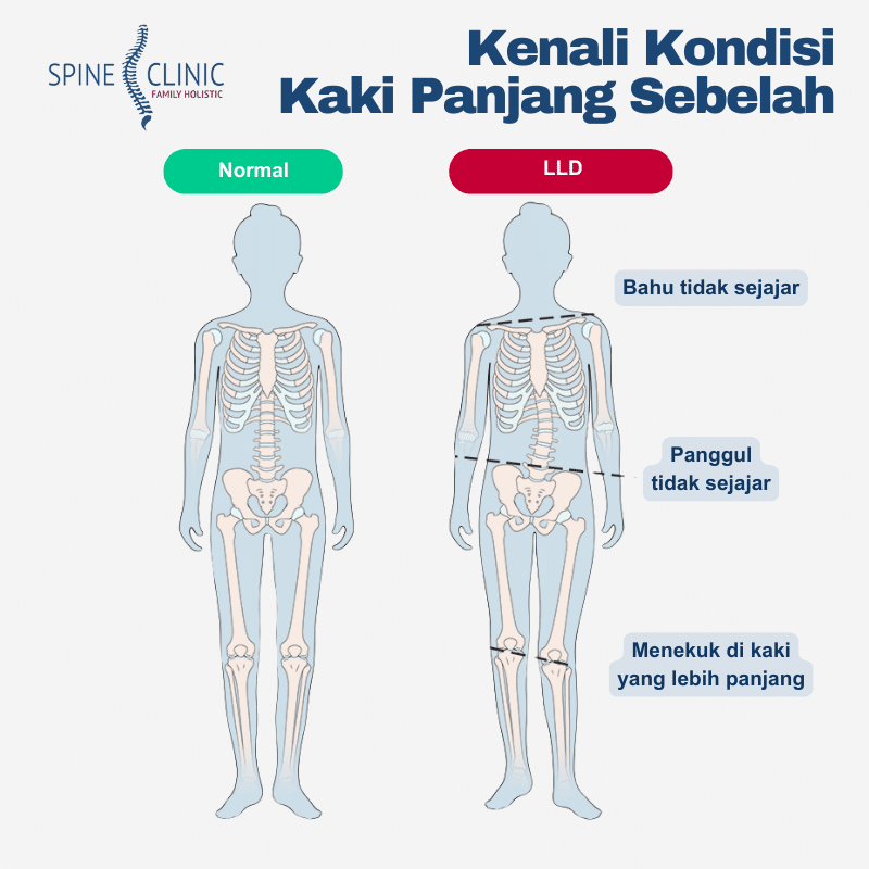 kaki panjang sebelah