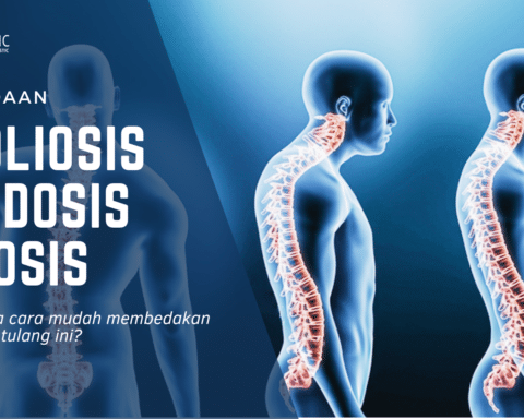 skoliosis lordosis kifosis