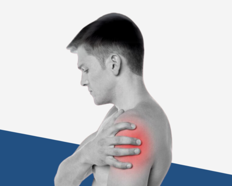 Shoulder Impingement Syndrome