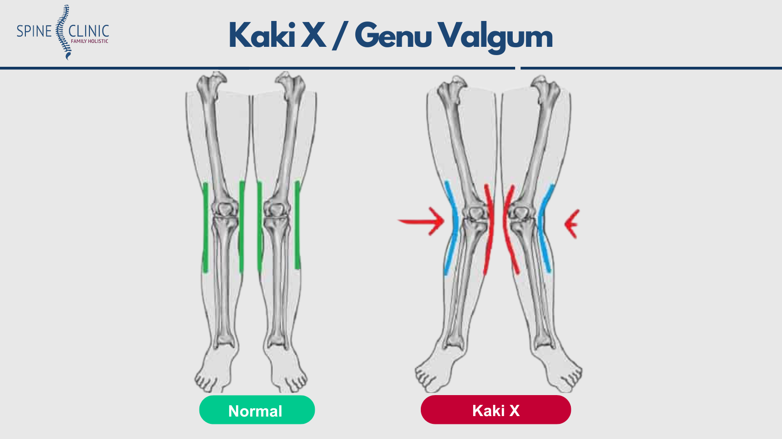 kaki x adalah