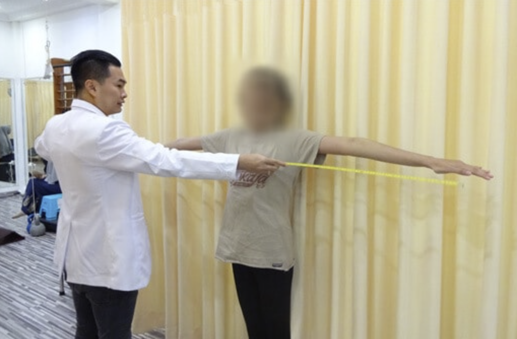 pasien dengan marfan syndrome