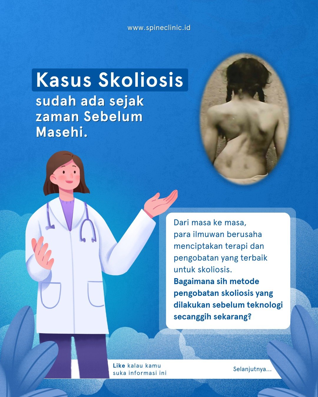 kasus skoliosis jaman dulu