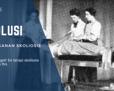 sejarah penanganan skoliosis