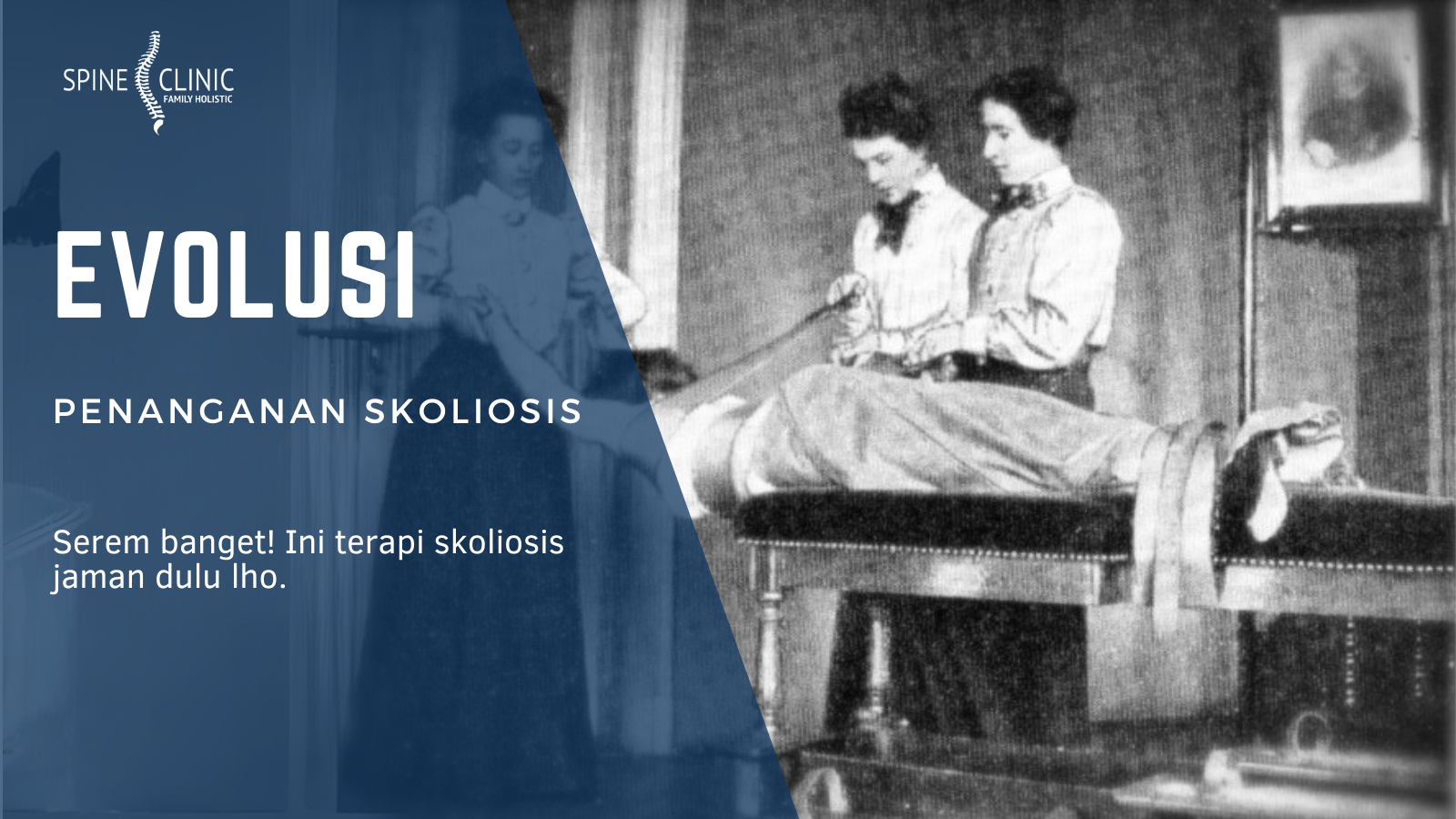 sejarah penanganan skoliosis