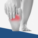 Morton’s Neuroma