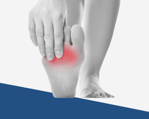 Morton’s Neuroma