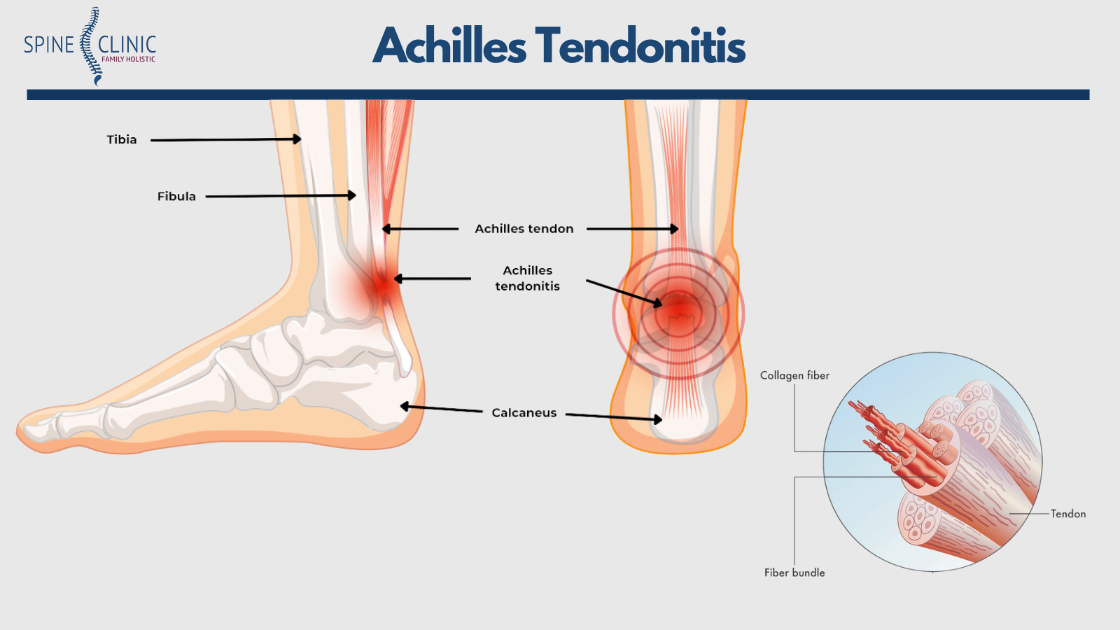 Anatomi tendon Achilles yang menghubungkan otot betis ke tulang tumit