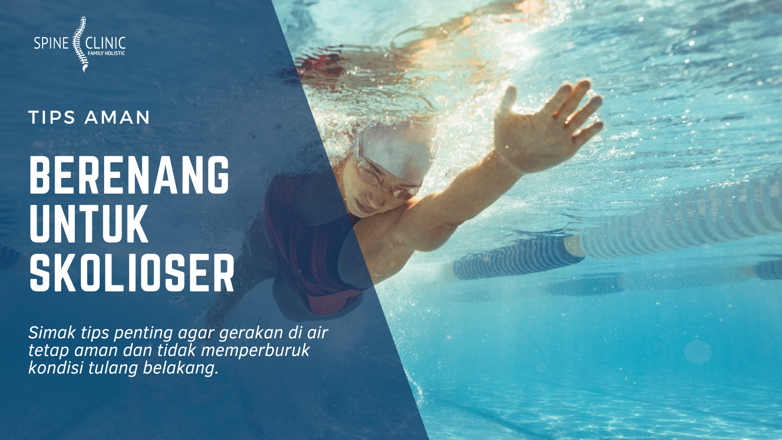 berenang untuk skoliosis