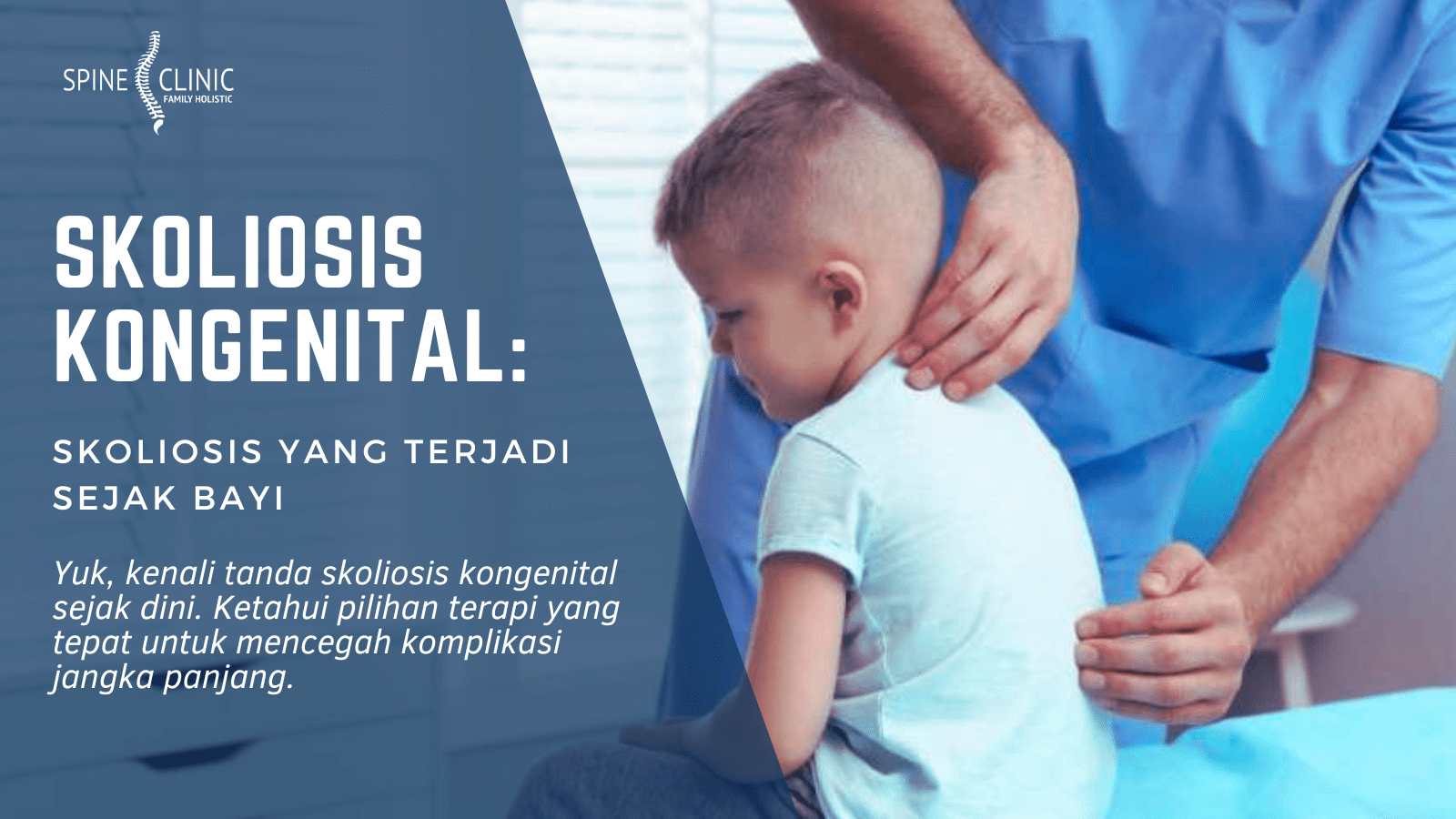 Skoliosis Kongenital