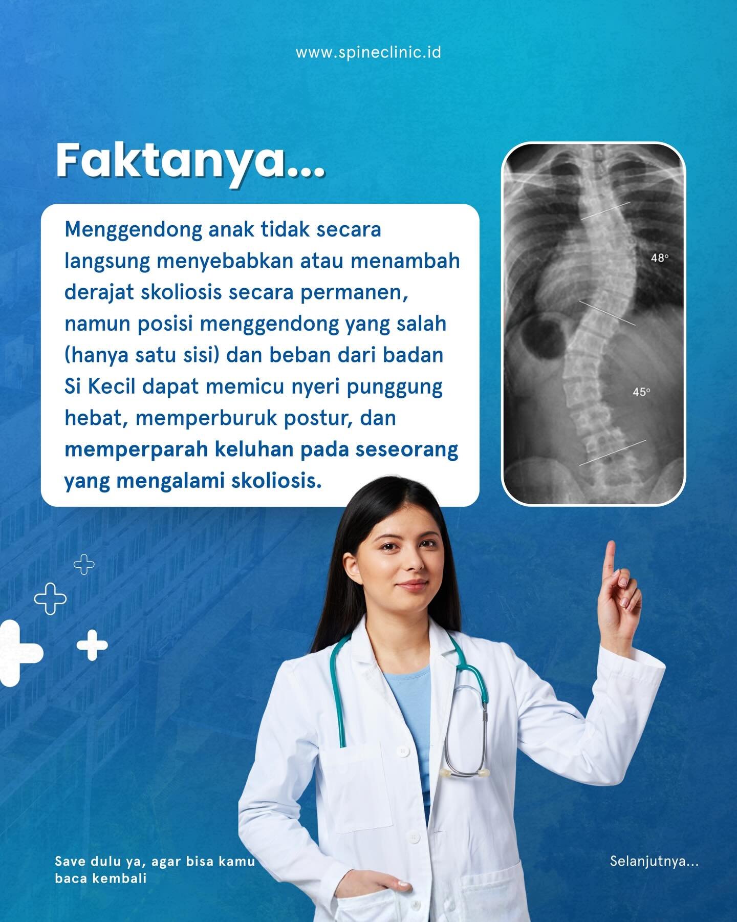 apakah menggendong anak dapat memperparah skoliosis