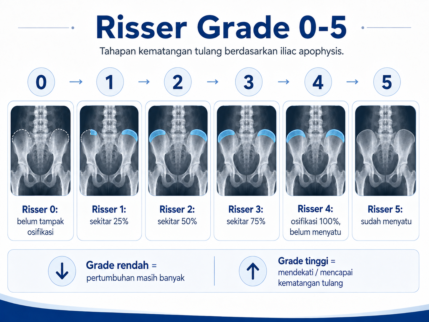 penjelasan risser grade 0-5