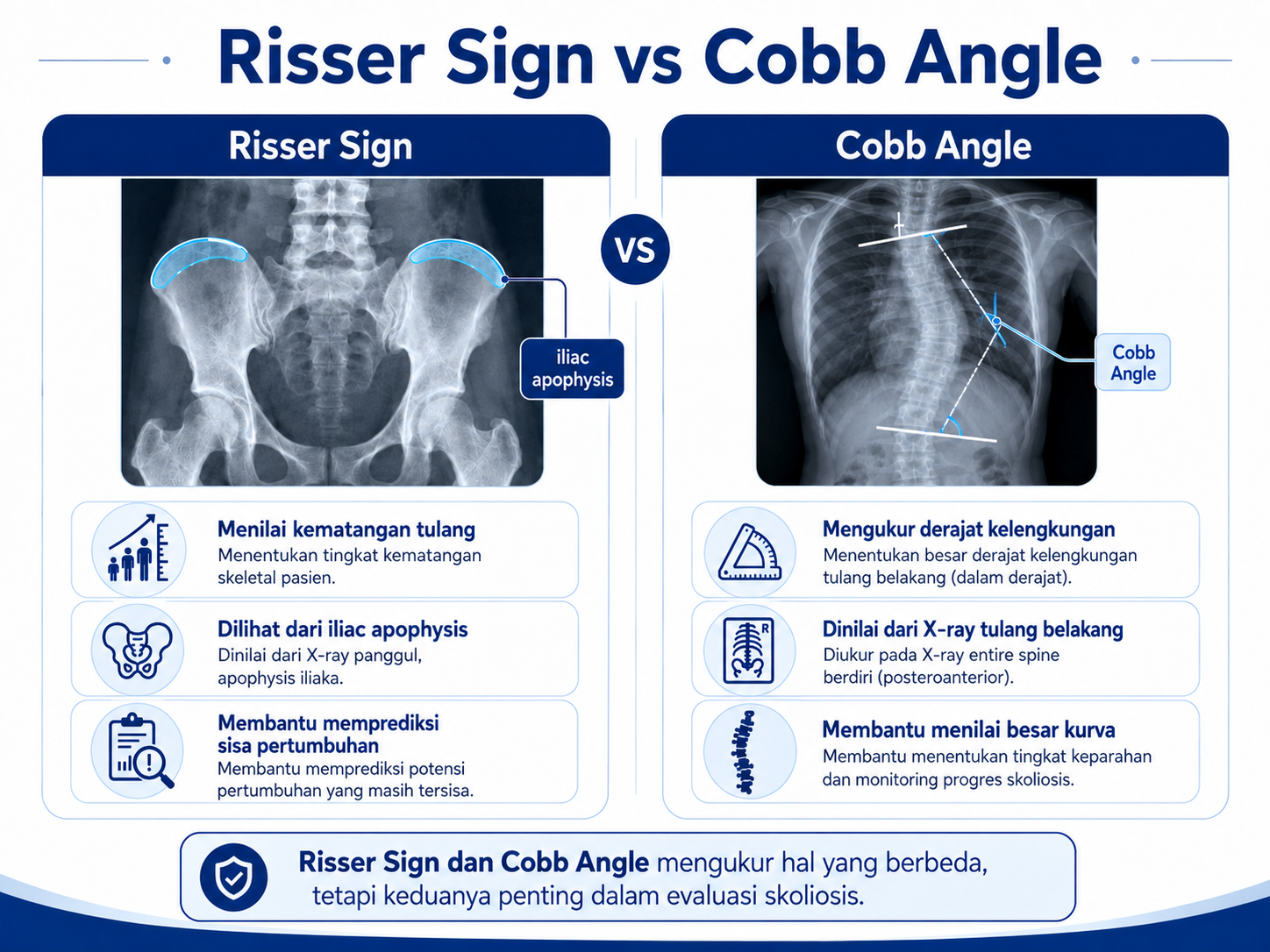 perbedaan risser sign dan cobb angle