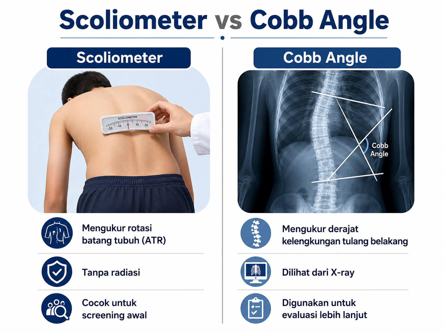 scoliometer vs cobb angle