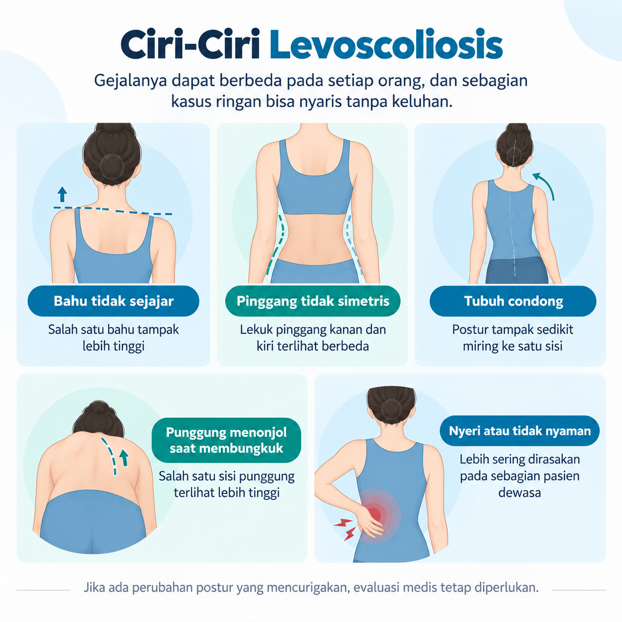 ciri ciri levoscoliosis