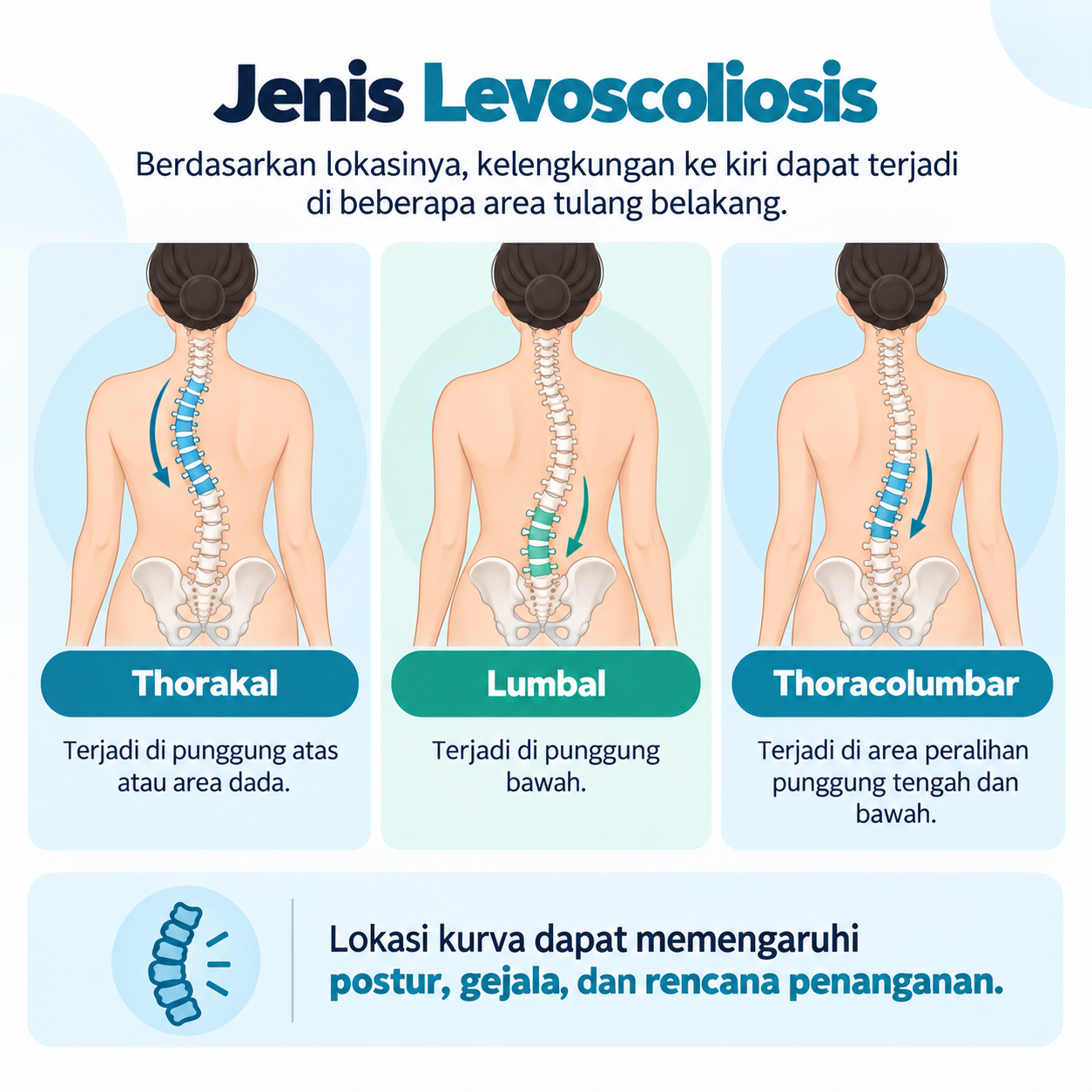 jenis levoscoliosis